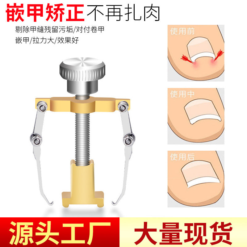 Inset Nail Straightener Nail Groove Special Nail Straightener Stainless Steel Corrector Toe Inset Nail Roll Pedicure Tool Inflammation